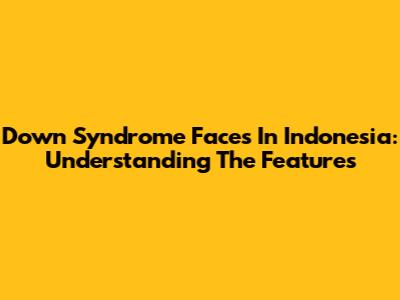 Down Syndrome Faces In Indonesia: Understanding The Features