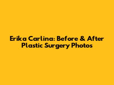 Erika Carlina: Before & After Plastic Surgery Photos