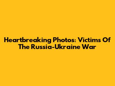 Heartbreaking Photos: Victims Of The Russia-Ukraine War