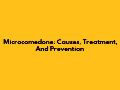 Microcomedone: Causes, Treatment, And Prevention