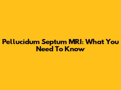 Pellucidum Septum MRI: What You Need To Know