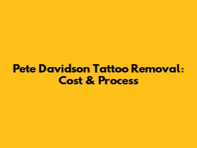 Pete Davidson Tattoo Removal: Cost & Process