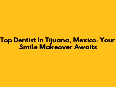 Top Dentist In Tijuana, Mexico: Your Smile Makeover Awaits