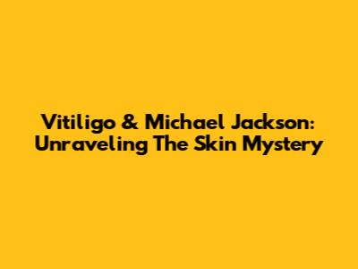 Vitiligo & Michael Jackson: Unraveling The Skin Mystery